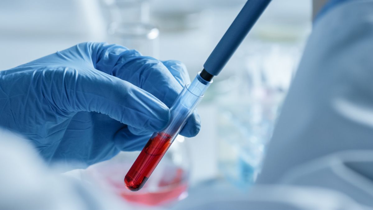 le test sanguin incontournable pour votre santé cet automne